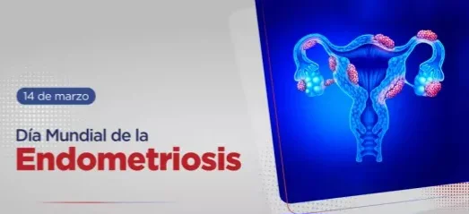 106770-el-diagnostico-temprano-es-clave-para-el-tratamiento-de-la-endometriosis