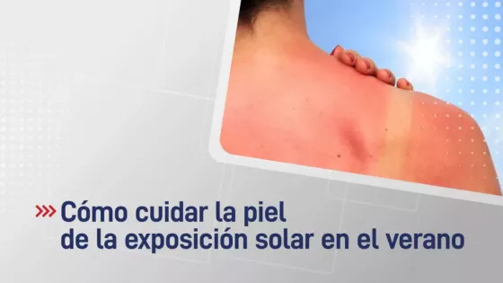 105829-como-cuidar-la-piel-de-la-exposicion-solar-en-el-verano