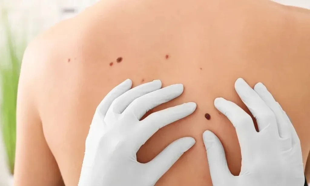 chequeodelunares3-1024x614